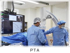 X線血管撮影装置（PTA）